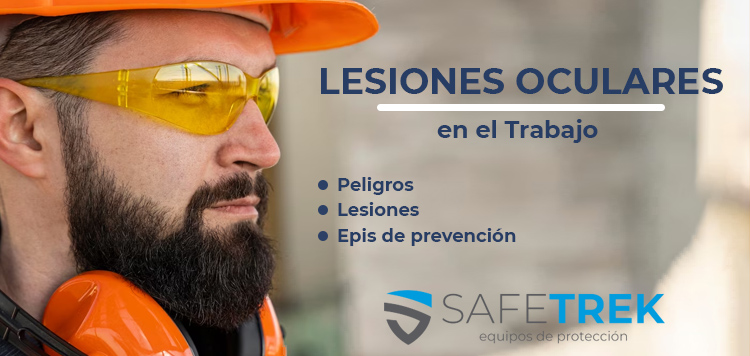 Lesiones oculares en el trabajo